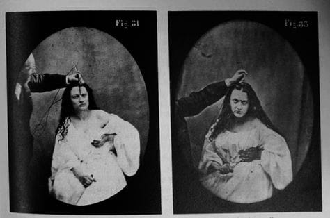 Hysteria: The Shaky Foundation of Psychoanalysis